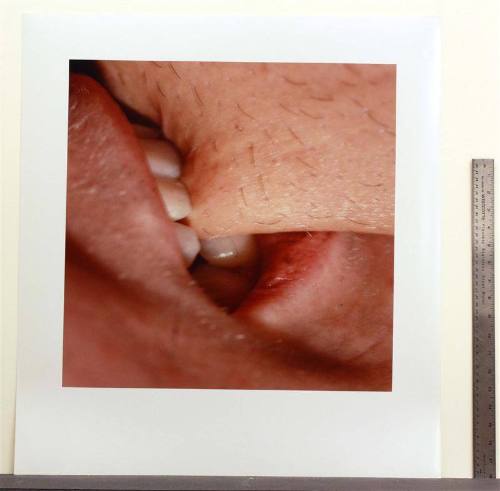 Fissure