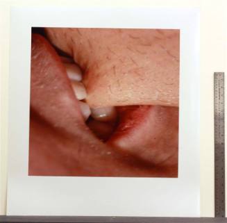 Fissure